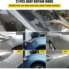 image:imageVEVOR Rods Dent Removal Kit 13 Pcs Paintless Dent Repair Rods Stainless Steel Dent Rods Whale Tail Dent Repair Tools Professional Hail Dent Removal Tool For Minor Dents Door Dings And Hail Damage21 Pcs with 21 Rods